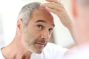 علت ریزش موی بدن